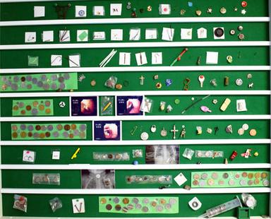 Batterie a bottone, in 3 mesi 6 ricoveri al Bambino Gesù per gravi lesioni all'esofago
