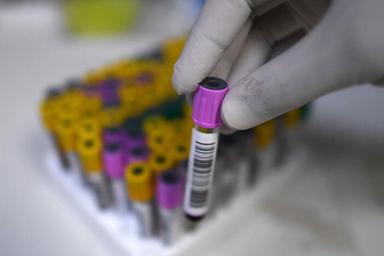 Linfoma a grandi cellule, anticorpo e chemioterapia nuovo trattamento seconda linea