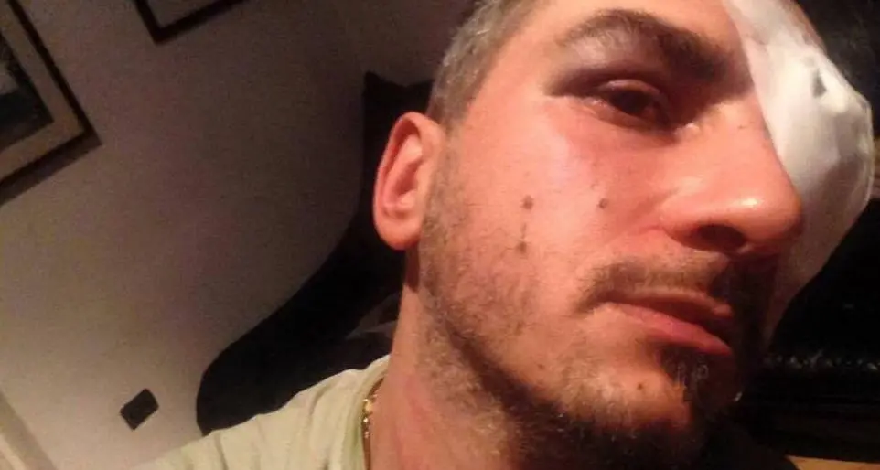 Bolzano, pestato in strada per una sbarra rotta