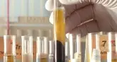 Batterio killer: scatta la profilassi in Alto Adige