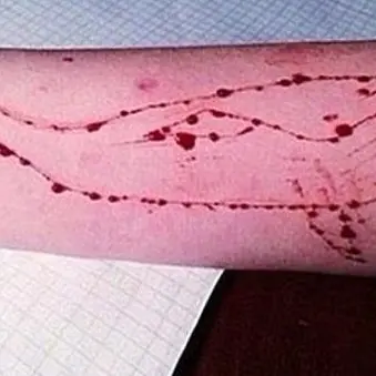 Blue Whale, in Bassa Atesina la prima denuncia