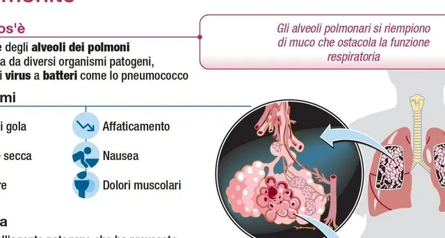 Polmonite, assessore: no chiusura scuole