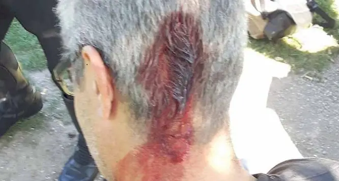 Brutale aggressione al direttore della «SportCity»