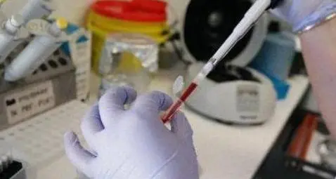 Caso legionella, due anziani erano morti al santa Chiara
