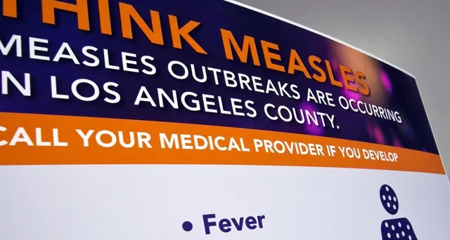 Morbillo: 60 nuovi casi negli Usa