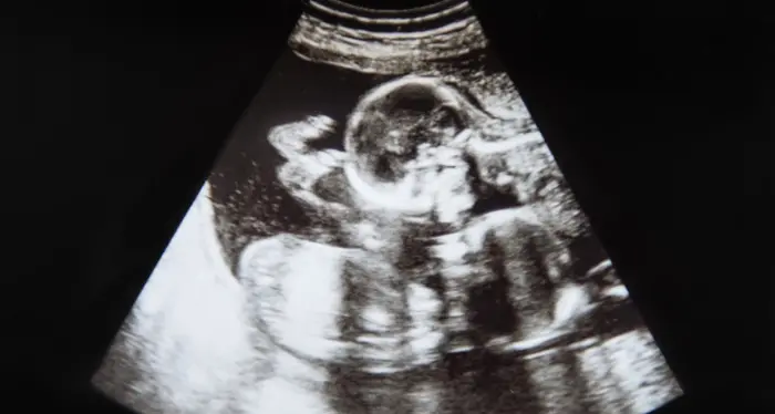 Una donna indiana di 73 anni partorisce due gemelle