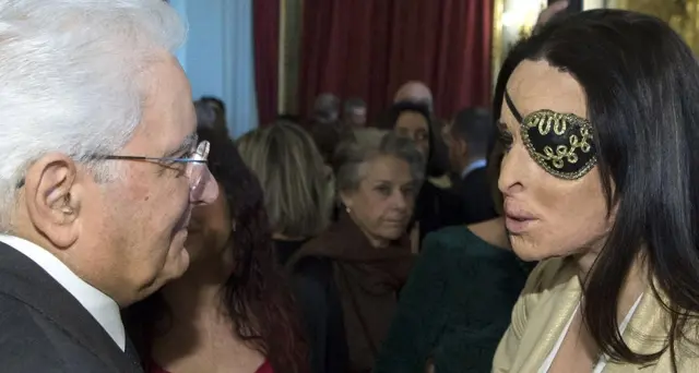 Gessica Notaro si opera all'occhio