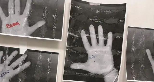 Infermieri, foto a mani per farsi forza
