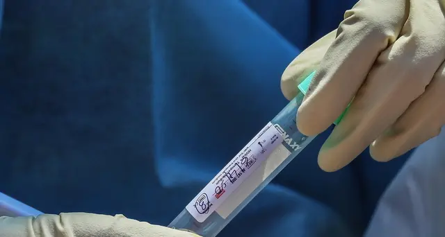 Test immunità, pochi giorni validazione