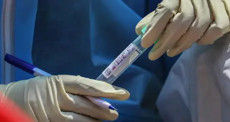 Coronavirus, \"test di immunità\" per tutti gli 8 mila residenti nei comuni trentini \"zona rossa\"