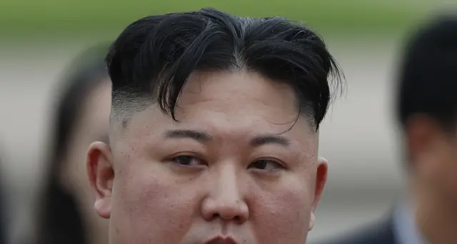 Seul: Kim non sembra sia stato operato