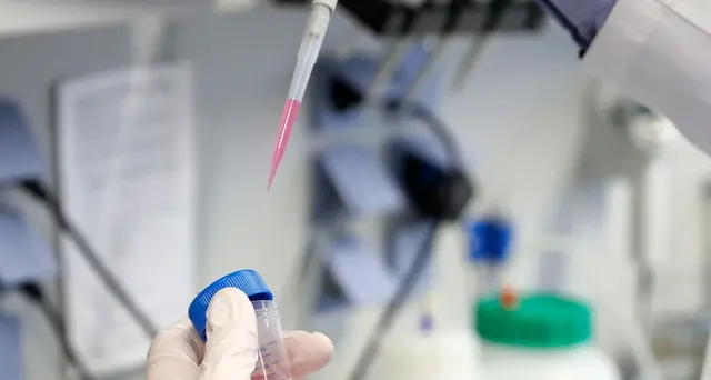 Coronavirus, 65 vittime in ultime 24 ore