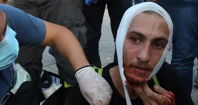Beirut, oltre 230 i manifestanti feriti nelle proteste