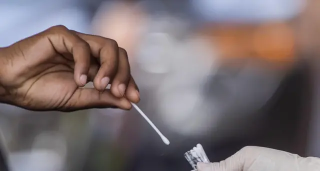 Usa, Fda approva primo test rapido anti Covid da fare a casa