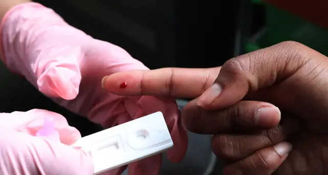 Ue, Hiv è ancora grave problema di salute pubblica