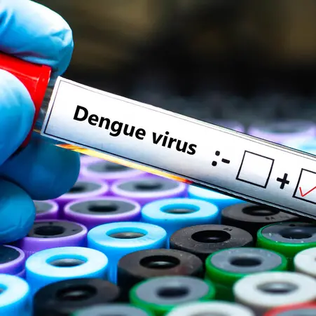 Scatta la disinfestazione dopo un caso di dengue importata