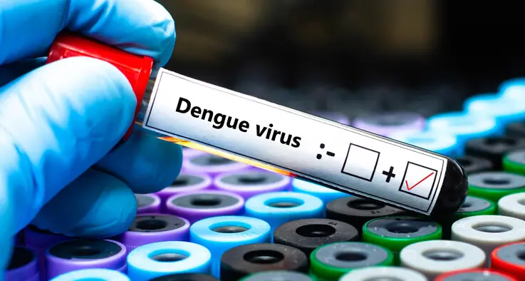 Scatta la disinfestazione dopo un caso di dengue importata