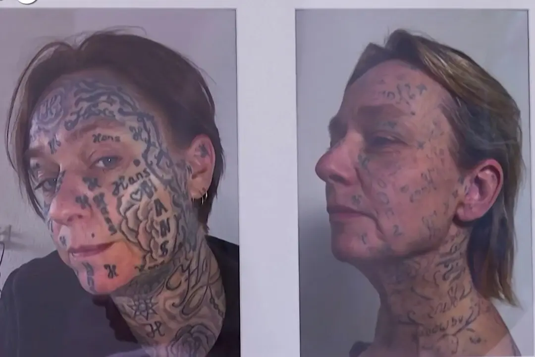 Costrette a tatuarsi dai partner violenti, in Olanda le vittime cancellano i marchi