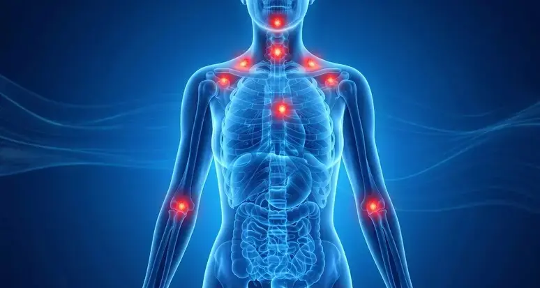Fibromialgia, scoperti 26 geni che aumentano il rischio della malattia
