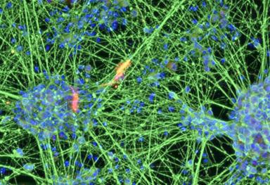Vecchie cellule del sangue trasformate in giovani neuroni