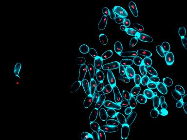 I lieviti nel kefir riportano equilibrio nel microbiota intestinale