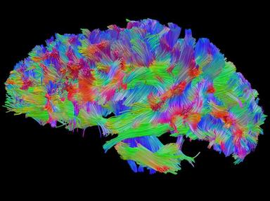 Lo stress vissuto nell'infanzia lascia cicatrici nel cervello