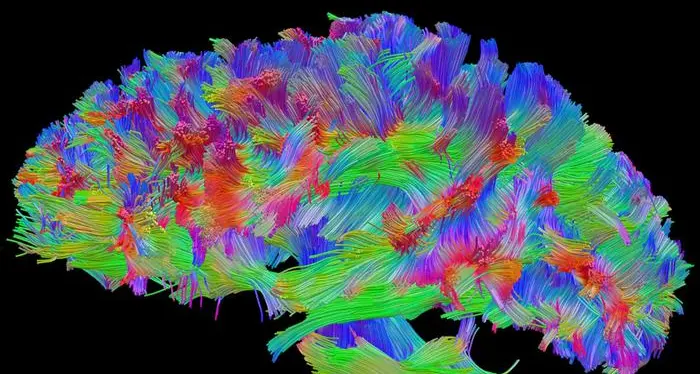 Lo stress vissuto nell'infanzia lascia cicatrici nel cervello