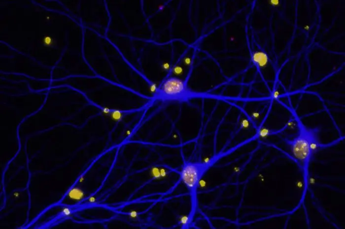 Un farmaco contro le lesioni spinali efficace anche contro l'Alzheimer