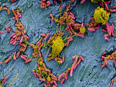 Il sistema immunitario reagisce ai microbi ancor prima di riconoscerli