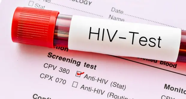 Aids, Caritas: \"La vera malattia è il pregiudizio\"