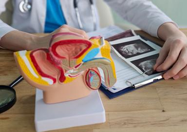 Tumore della prostata, terapia 'tris' riduce il rischio di metastasi del 58%