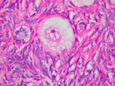 L'ovaio non va in pensione dopo la menopausa, continua a cambiare