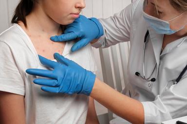 Aumentano i casi di morbillo, 472 nei primi 5 mesi dell'anno