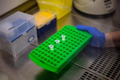 L'Ue invia all'Oms test Pcr sull'Ebola per 2,1 milioni di euro