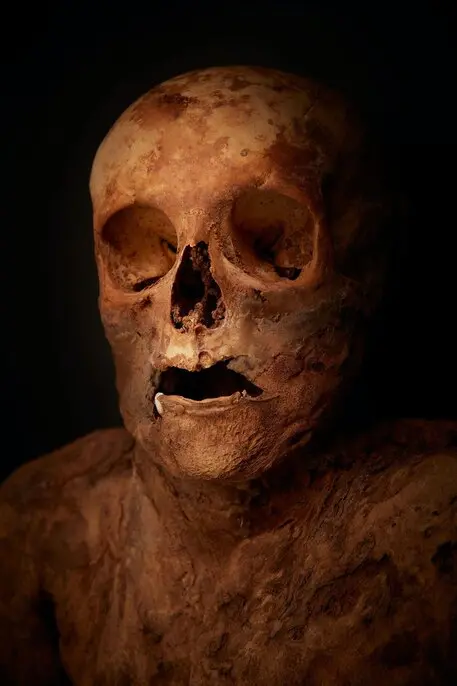 I ricercatori dell’Eurac risolvono «il giallo» della mummia di Basilea: la donna non morì di sifilide