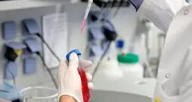 Coronavirus: 263 casi positivi da PCR e 80 da test antigenici