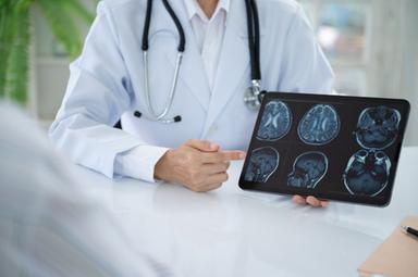 Il Parkinson, la malattia neurodegenerativa in più rapida crescita