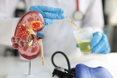 Malattie renali, un test anticipa la diagnosi ma è poco diffuso