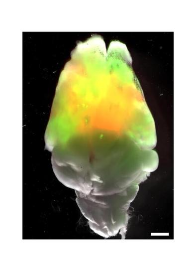 Organoidi di cervello umano in topi, hanno formato circuiti