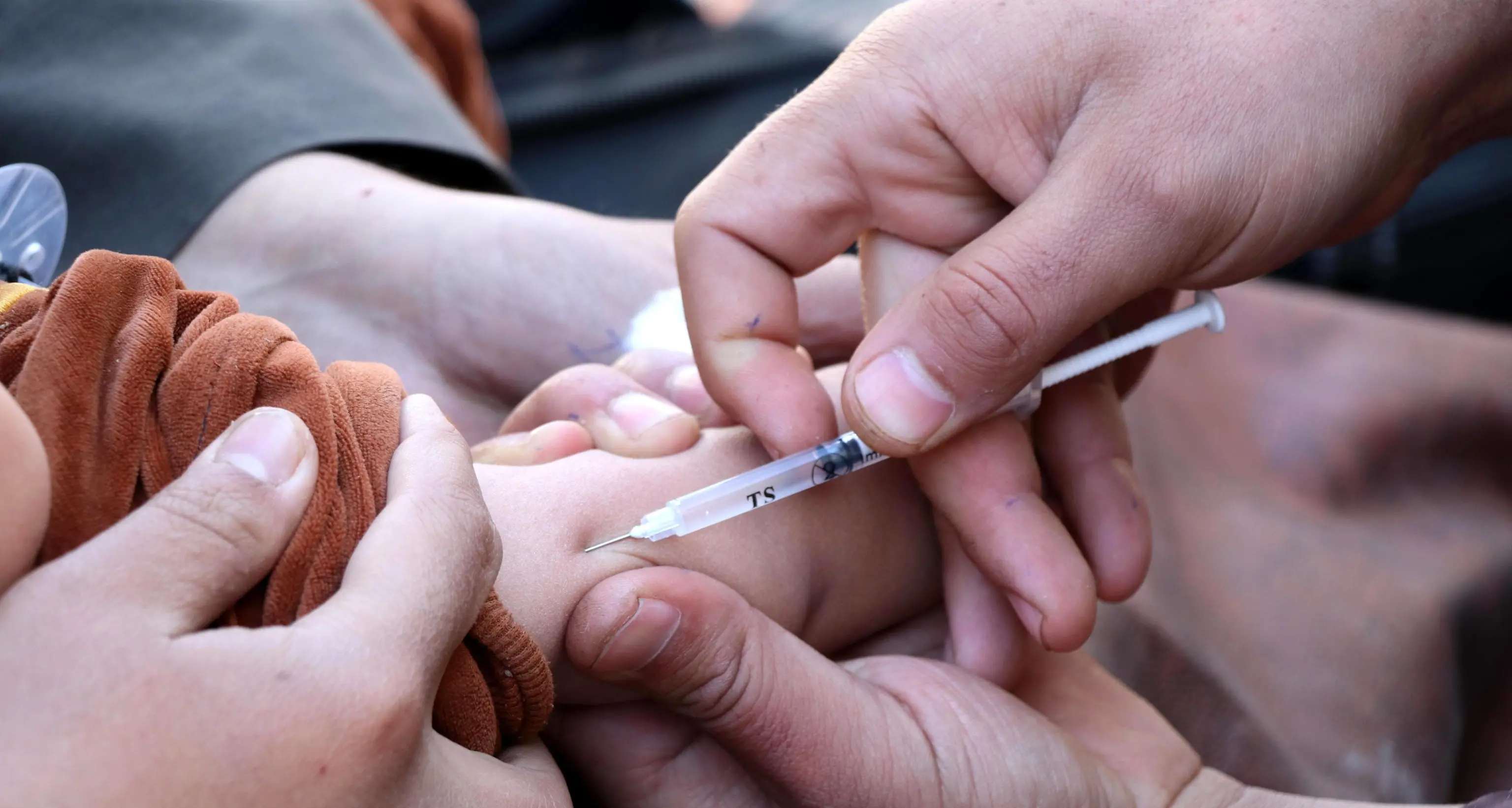 Morbillo:+3.000% casi in Europa e Asia centrale da gennaio