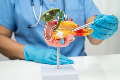 Diabete, l'uso di semaglutide non aumenta il rischio di cancro al pancreas