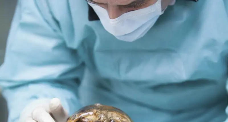 Pelle scura, calvo e tendente all'obesità: ecco com’era Ötzi