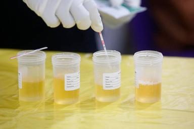 Fentanyl, possibili falsi positivi nei test rapidi in presenza di un farmaco