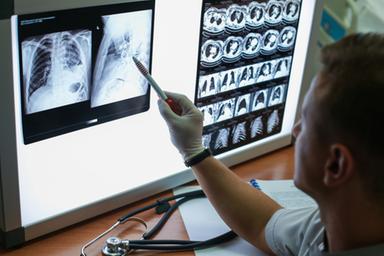 Tumore del polmone, dati positivi da un nuovo vaccino terapeutico