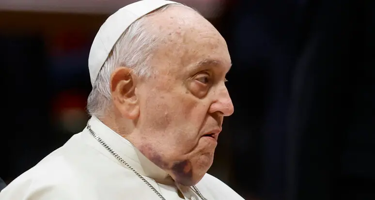 Papa Francesco, lieve insufficienza renale. Il mondo in apprensione