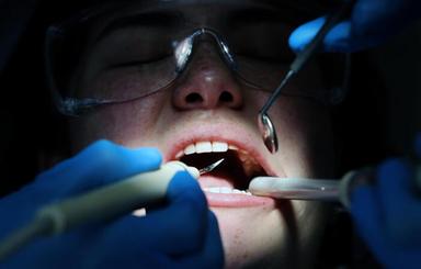 Ordini odontoiatri, 'bene lo sblocco delle scuole di specializzazione'