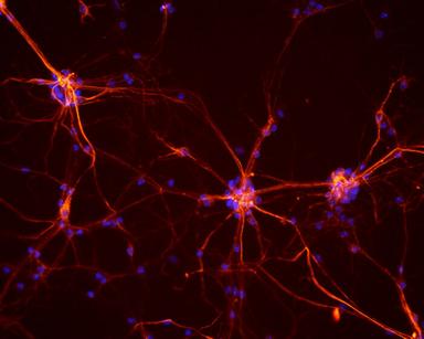 Cos'è l'optogenetica, tecnica che in 20 anni ha fatto il giro del mondo