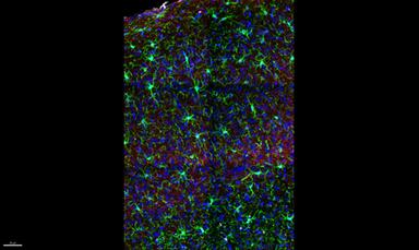 Il cervello femminile è più plastico, i test al risveglio dall'anestesia