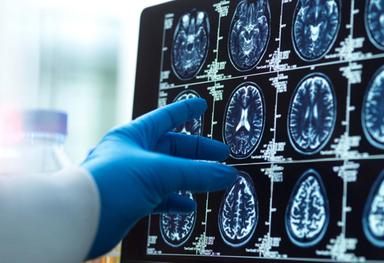 In Gb prima operazione per rimuovere tumore al cervello con l'aiuto dell'IA