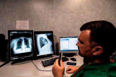 Tumore del seno, grazie a progetto oltre 1.600 mammografie per le donne fragili